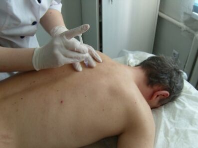 Kondroprotektorite intraartikulaarsed süstid rindkere osteokondroosi korral